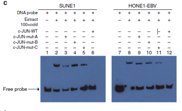 miR-3188 regulates nasopharyngeal carcinoma proliferation and chemosensitivity through aFOXO1-modulated positive feedback loop with mTOR–p-PI3K/AKT-c-JUN