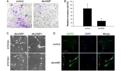 Transcriptional upregulation of microtubule-associated protein 2 is involved in the protein kinase A-induced decrease in the invasiveness of glioma cells