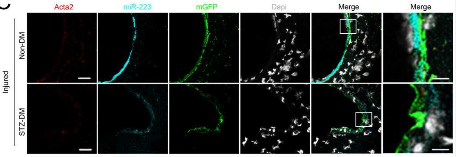 Platelet-derived miR-223 promotes a phenotypic switch in arterial injury repair