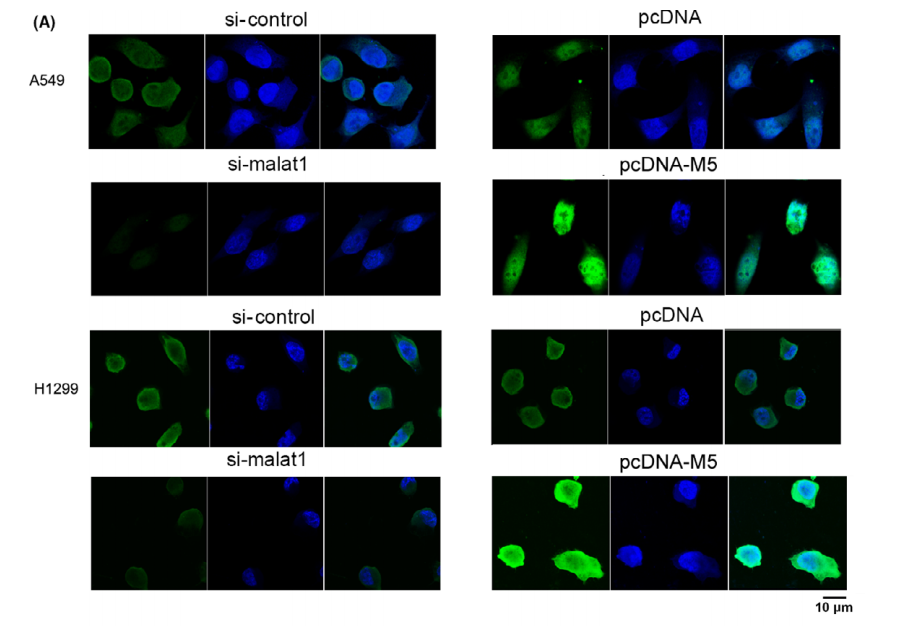 Long non-coding RNA metastasis-associated lung adenocarcinoma transcript 1 promotes lung adenocarcinoma by directly interacting with specificity protein 1