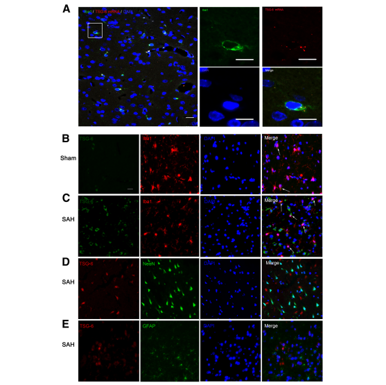 TSG-6 attenuates inflammation-induced brain injury via modulation of microglial polarization in SAH rats through the SOCS3/STAT3 pathway
