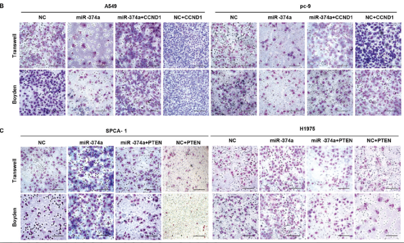Dual roles of miR-374a by modulated c-Jun respectively targets CCND1-inducing PI3K/AKT signal and PTEN-suppressing Wnt/β-catenin signaling in non-small-cell lung Cancer
