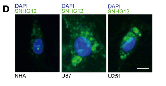 Inhibition of TDP43-Mediated SNHG12-miR-195-SOX5 Feedback Loop Impeded Malignant Biological Behaviors of Glioma Cells
