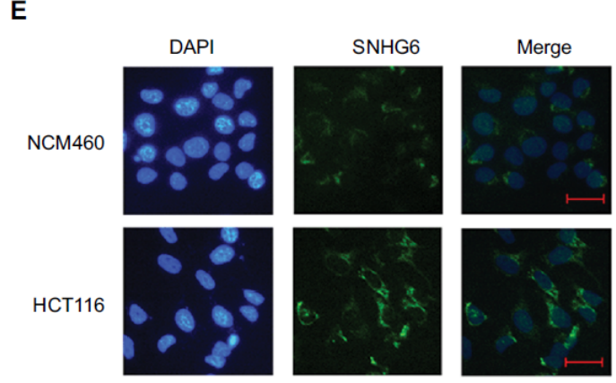 Long noncoding RNA SNHG6 functions as a competing endogenous RNA by sponging miR-181a-5p to regulate E2F5 expression in colorectal cancer