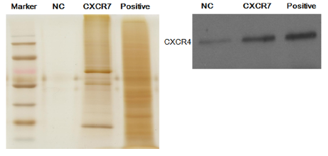 The potential role of stromal cell-derived factor-1α/CXCR4/ CXCR7 axis in adipose-derived mesenchymal stem cells