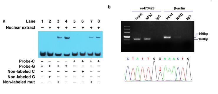 Genetic Predisposition to Glioma Mediated by a MAPKAP1 Enhancer Variant