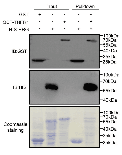 HRG switches TNFR1-mediated cell survival to apoptosis in Hepatocellular Carcinoma 