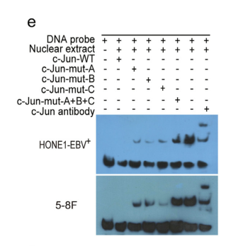 Cinobufotalin powerfully reversed EBV-miR-BART22-induced cisplatin resistance via stimulating MAP2K4 to antagonize non-muscle myosin heavy chain IIA/glycogen synthase 3β/β-catenin signaling pathway