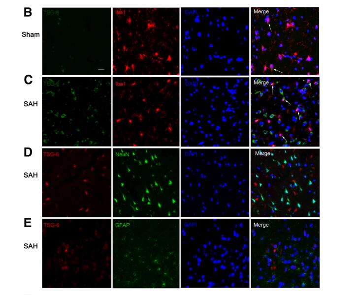 TSG-6 attenuates inflammation-induced brain injury via modulation of microglial polarization in SAH rats through the SOCS3/STAT3 pathway