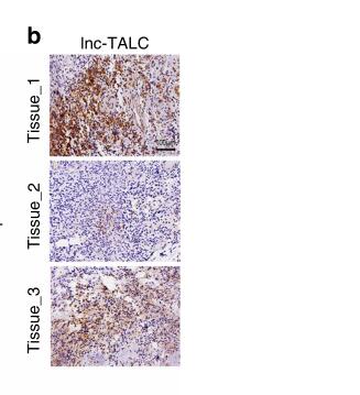 Lnc-TALC promotes O6-methylguanine-DNA methyltransferase expression via regulating the c-Met pathway by competitively binding with miR-20b-3p