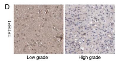 lncRNA TPTEP1 inhibits stemness and radioresistance of  glioma through miR‑106a‑5p‑mediated P38 MAPK signaling