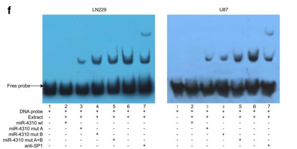MiR-4310 induced by SP1 targets PTEN  to promote glioma progression