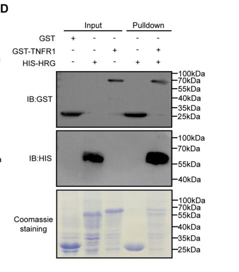 HRG switches TNFR1-mediated cell survival to  apoptosis in Hepatocellular Carcinoma