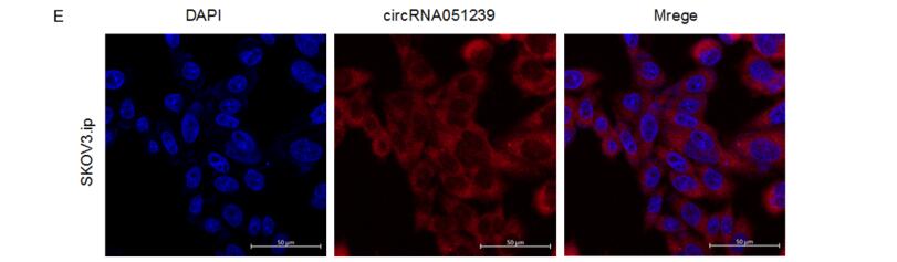 Tumor-derived exosomal circRNA051239 promotes   proliferation and migration of epithelial ovarian cance