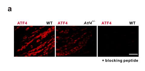 ATF4 selectively regulates heat nociception and contributes to kinesin-mediated TRPM3 trafficking