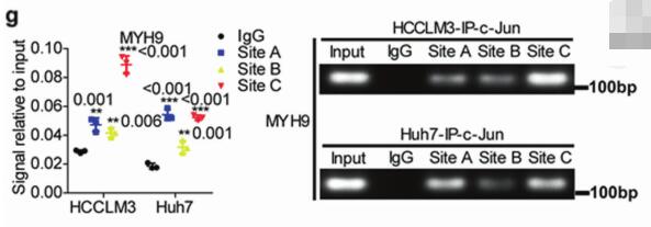 Silencing MYH9 blocks HBx-induced GSK3β ubiquitination and degradation to inhibit tumor stemness in hepatocellular carcinoma