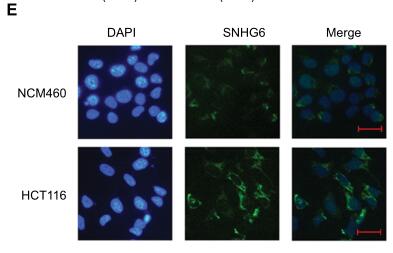 Long noncoding RNA SNHG6 functions as a competing endogenous RNA by sponging miR-181a-5p to regulate E2F5 expression in colorectal cancer