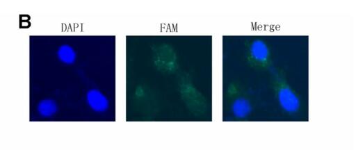 LncRNA RP11-86H7.1 promotes airway inflammation induced by TRAPM2.5 by acting as a ceRNA of miRNA-9-5p to regulate NFKB1 in HBECS