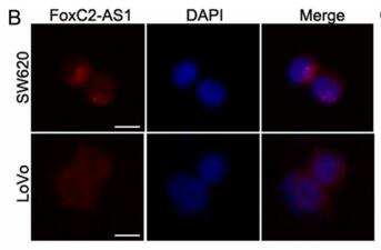 LncRNA FOXC2-AS1 enhances FOXC2 mRNA stability to promote colorectal cancer progression via activation of Ca 2+-FAK signal pathway