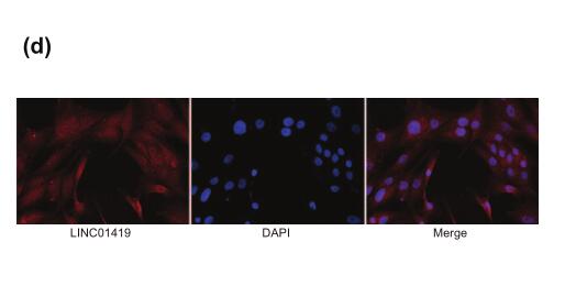 Overexpression of long noncoding RNA LINC01419 in esophageal squamous cell carcinoma and its relation to the sensitivity to 5-fluorouracil by mediating GSTP1 methylation