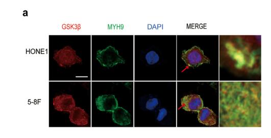 Cinobufotalin powerfully reversed EBV-miR-BART22-induced cisplatin resistance via stimulating MAP2K4 to antagonize non-muscle myosin heavy chain IIA/glycogen synthase 3β/β-catenin signaling pathway
