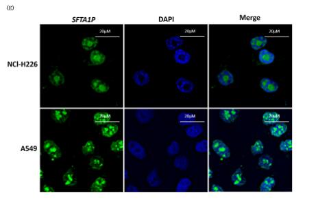 Long noncoding RNA SFTA1P promoted apoptosis and increased cisplatin chemosensitivity via regulating the hnRNP-U-GADD45A axis in lung squamous cell carcinoma