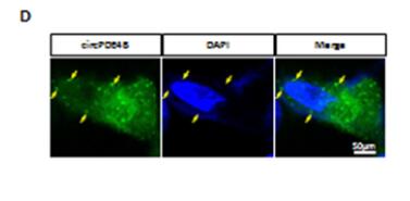 Circular RNAs in human and vertebrate neural retinas