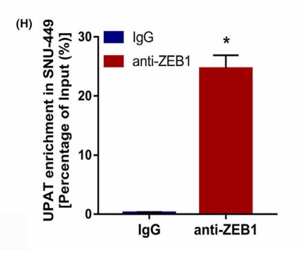 Deficiency of pseudogene UPAT leads to hepatocellular carcinoma progression and forms a positive feedback loop with ZEB1