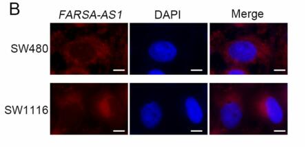 SOX9-activated FARSA-AS1 predetermines cell growth, stemness, and metastasis in colorectal cancer through upregulating FARSA and SOX9