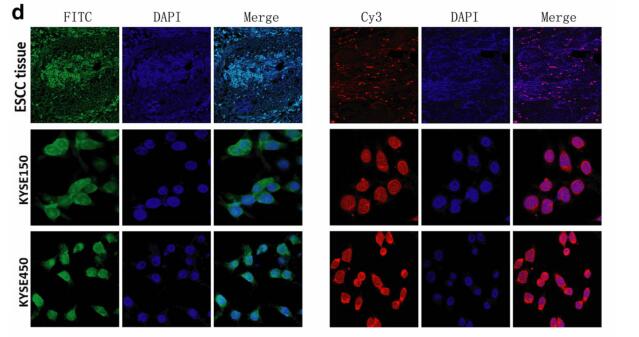 Up-regulation of lncRNA CASC9 promotes esophageal squamous cell carcinoma growth by negatively regulating PDCD4 expression through EZH2