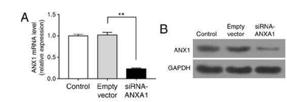 Silencing of Annexin A1 suppressed the apoptosis and inflammatory response of preeclampsia rat trophoblasts