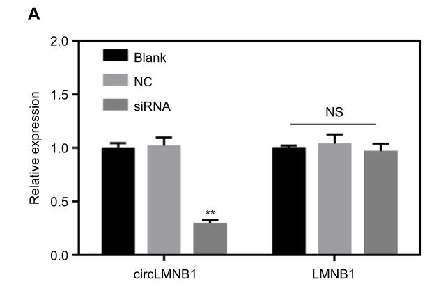 CircLMNB1 promotes colorectal cancer by regulating cell proliferation, apoptosis and epithelial-mesenchymal transition