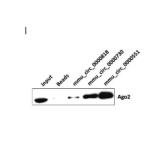 Gut microbiota regulate tumor metastasis via circRNA/miRNA networks