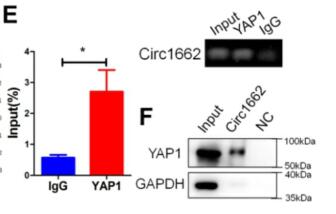 N6-methyladenosine-induced circ1662 promotes  metastasis of colorectal cancer by accelerating YAP1  nuclear localization