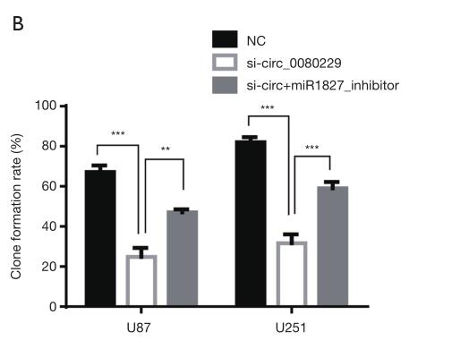 Hsa_circ_0080229 upregulates the expression of murine double minute-2 (MDM2) and promotes glioma tumorigenesis and invasion via the miR-1827 sponging mechanism