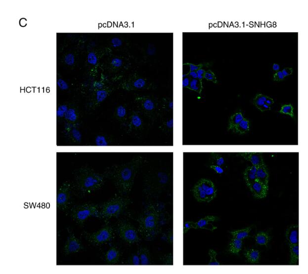 Long non-coding RNA SNHG8 promotes autophagy as a ceRNA to upregulate ATG7 by sponging microRNA-588 in colorectal cancer