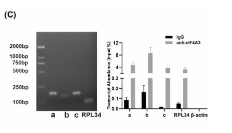 RPL34-AS1-induced RPL34 inhibits cervical cancer cell tumorigenesis via the MDM2-P53 pathway