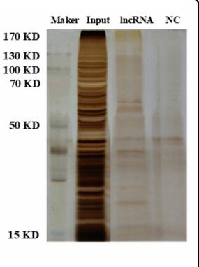 LINC-PINT impedes DNA repair and enhances radiotherapeutic response by targeting DNA-PKcs in nasopharyngeal cancer