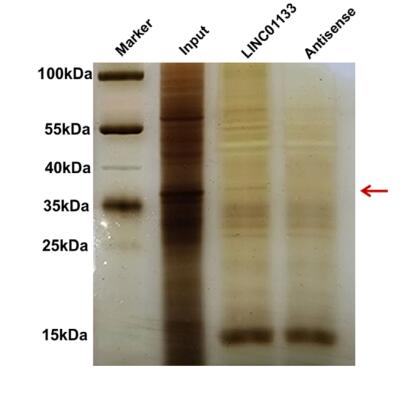 LINC01133 promotes hepatocellular carcinoma progression by sponging miR-199a-5p and activating annexin A2