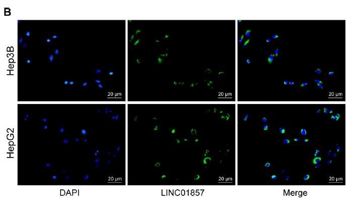 Role of long intergenic non-protein coding RNA 01857 in hepatocellular carcinoma malignancy via the regulation of the microRNA-197-3p/anterior GRadient 2 axis