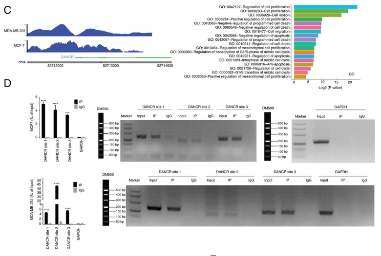 Long non‑coding RNA DANCR aggravates breast cancer through the miR‑34c/E2F1 feedback loop
