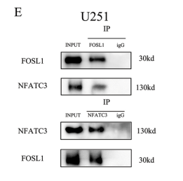 HNRNPA2B1 stabilizes NFATC3 levels to potentiate its combined actions with FOSL1 to mediate vasculogenic mimicry in GBM cells