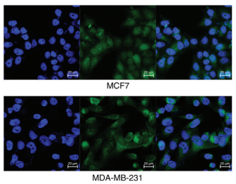Long non‑coding RNA DANCR aggravates breast cancer through the miR‑34c/E2F1 feedback loop