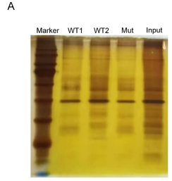 DNA G-Quadruplex in NRP1 Promoter Facilitates SARS-CoV-2 Infection