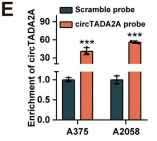 circTADA2A inhibited SLC38A1 expression and suppresses melanoma progression through the prevention of CNBP trans-activation